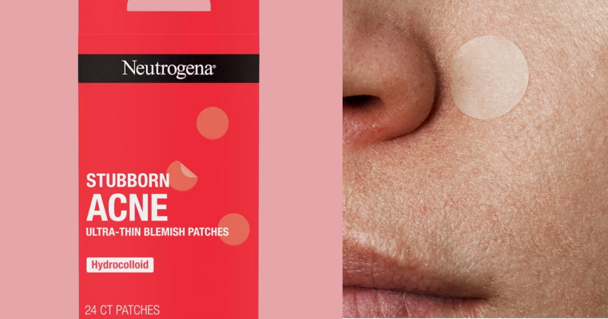 Possible Free Nuetrogena Stubborn Acne Blemish Patches Samples