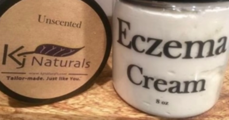 kj naturals eczema